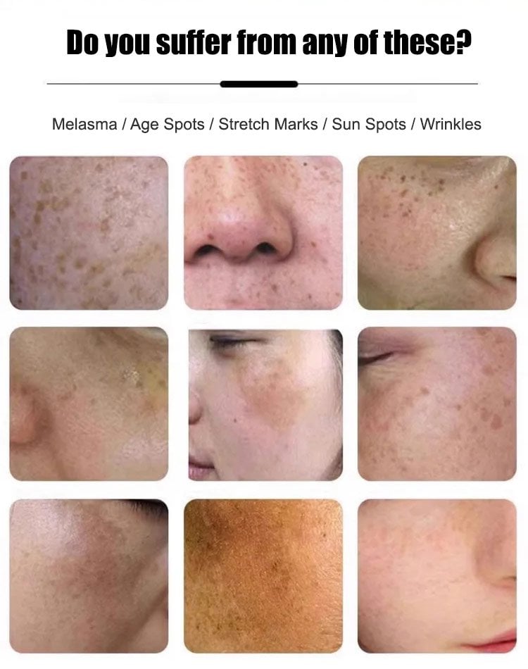RETINOL.jpeg