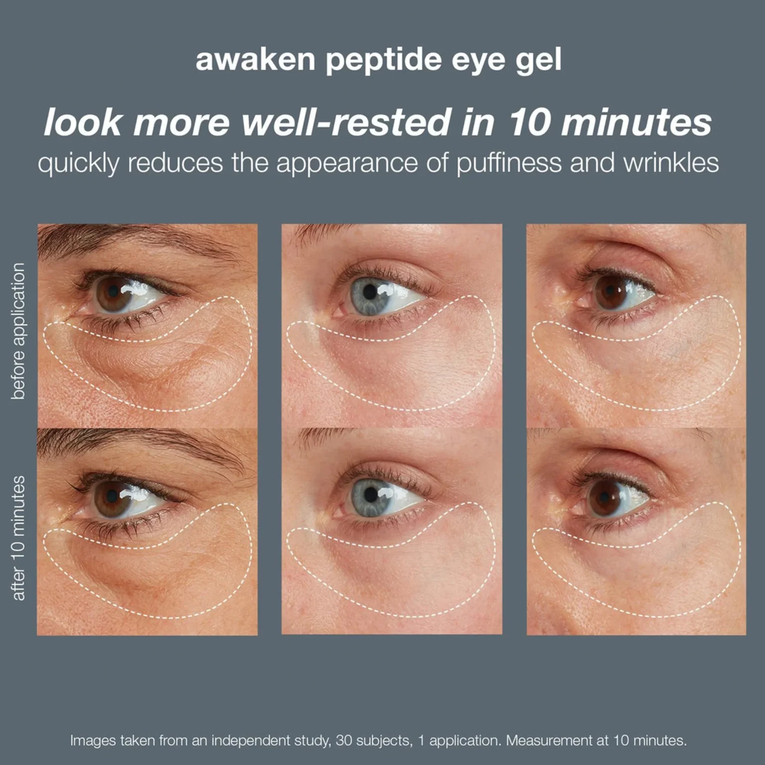 awaken-peptide-eye-gel4-2040-x-2040_2040x2040