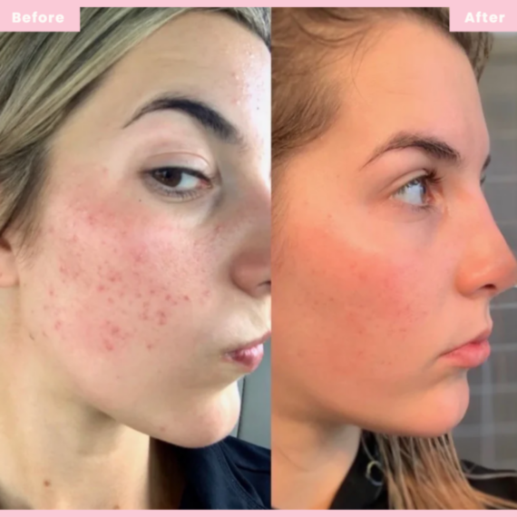 kojic10.png